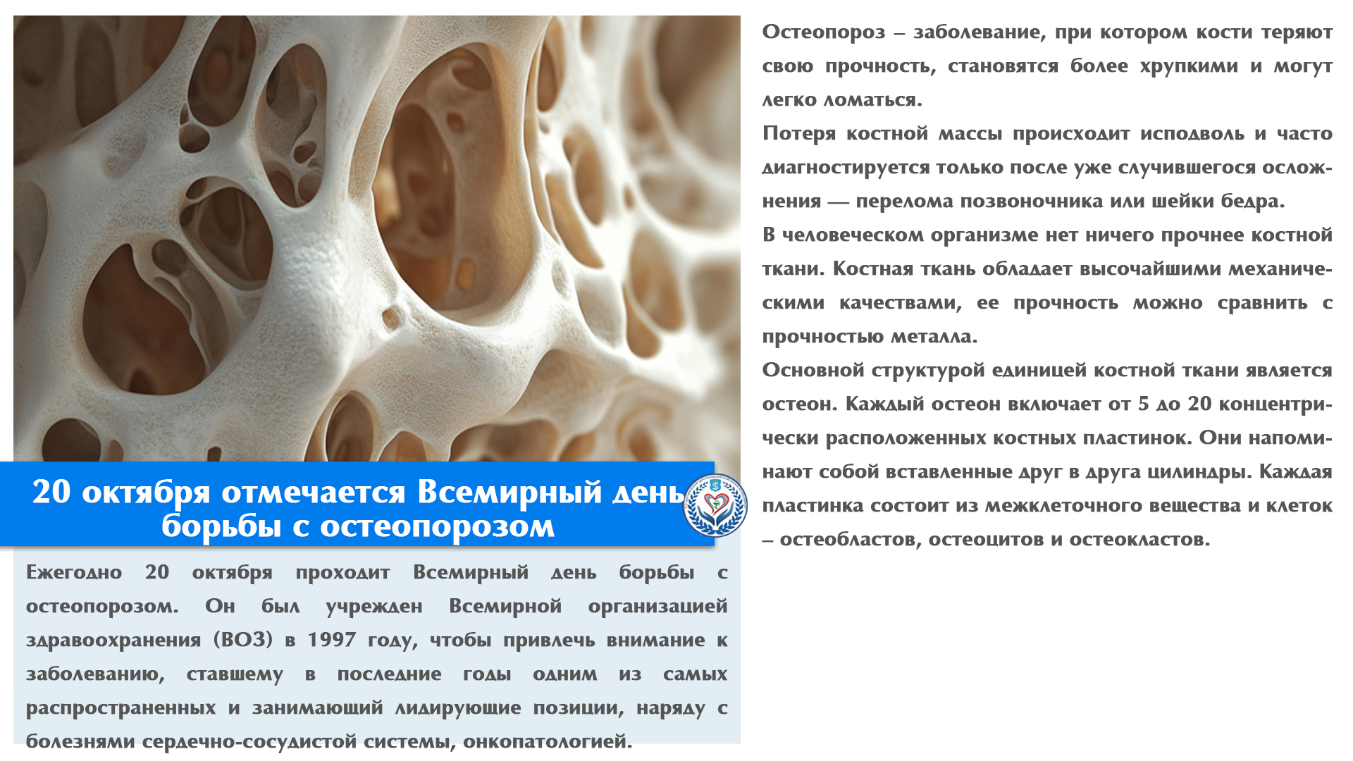 20 октября отмечается Всемирный день борьбы с остеопорозом