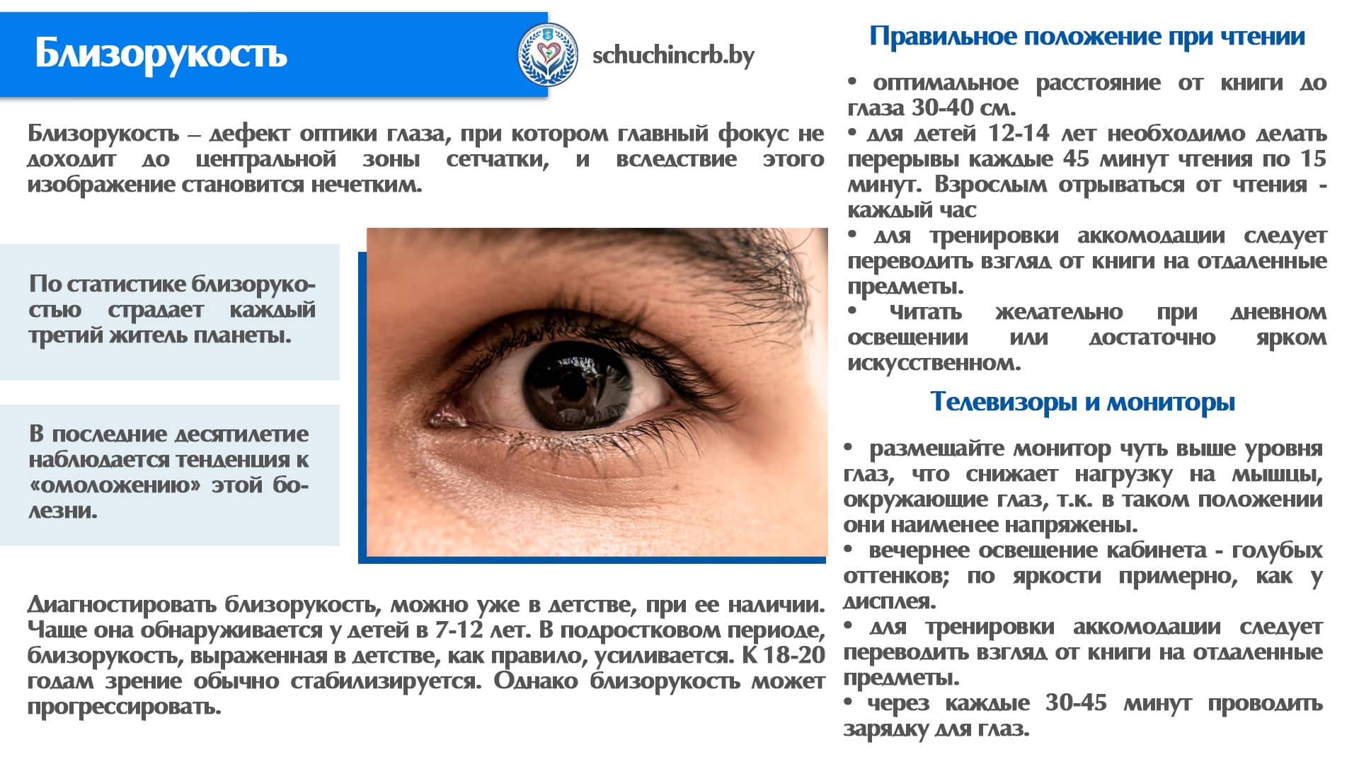 Близорукость