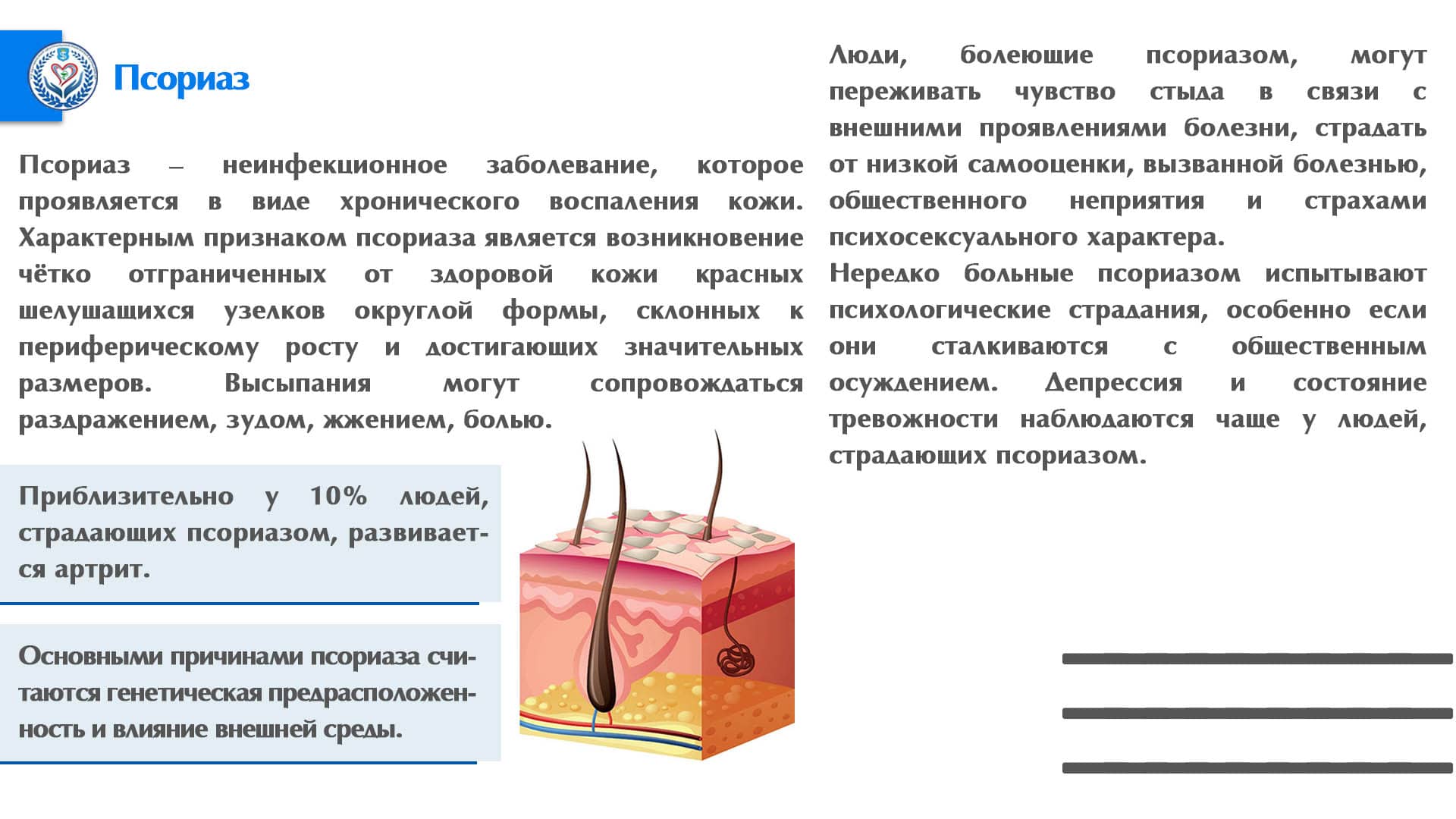 Псориаз