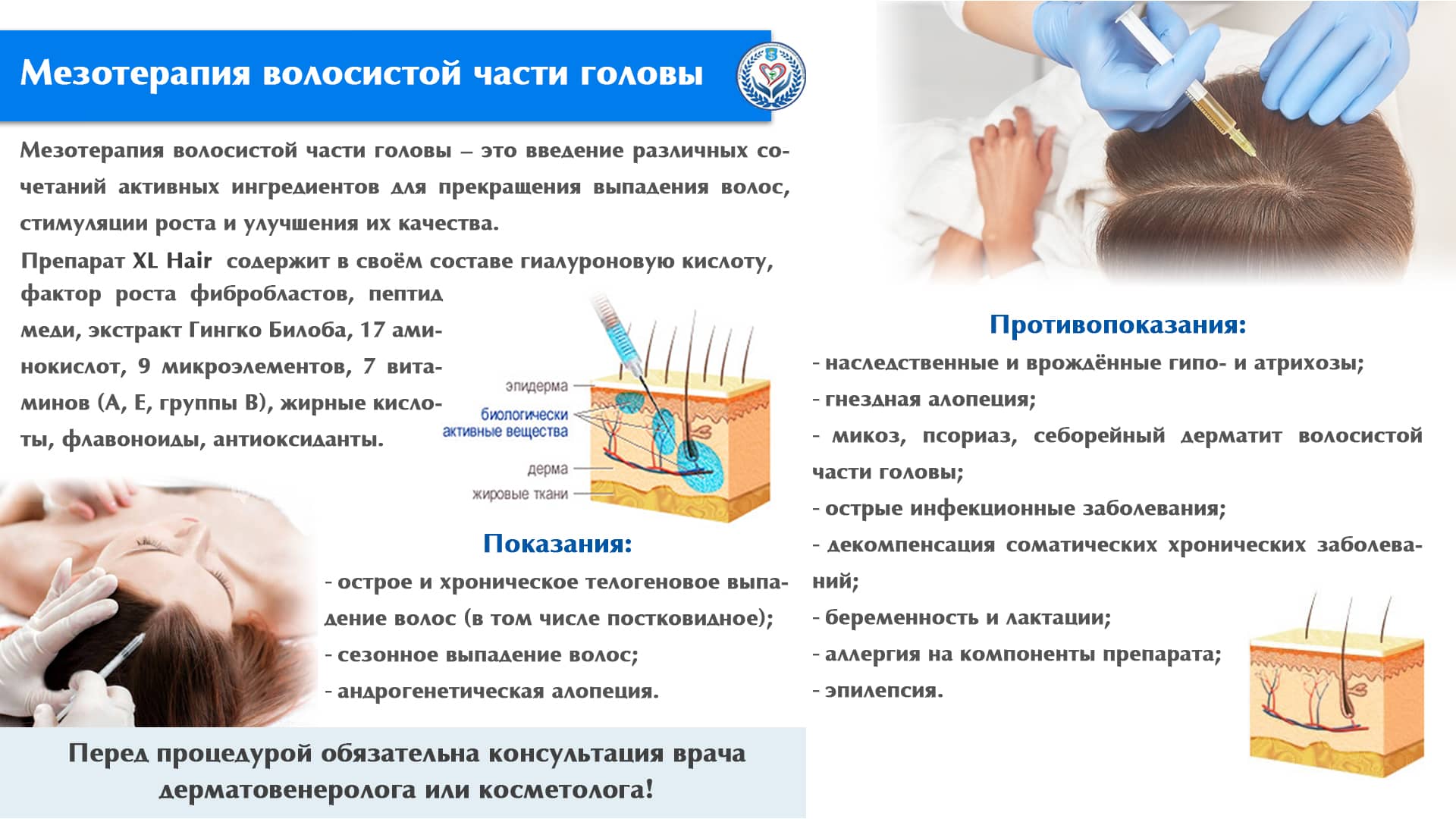 Мезотерапия волосистой части головы