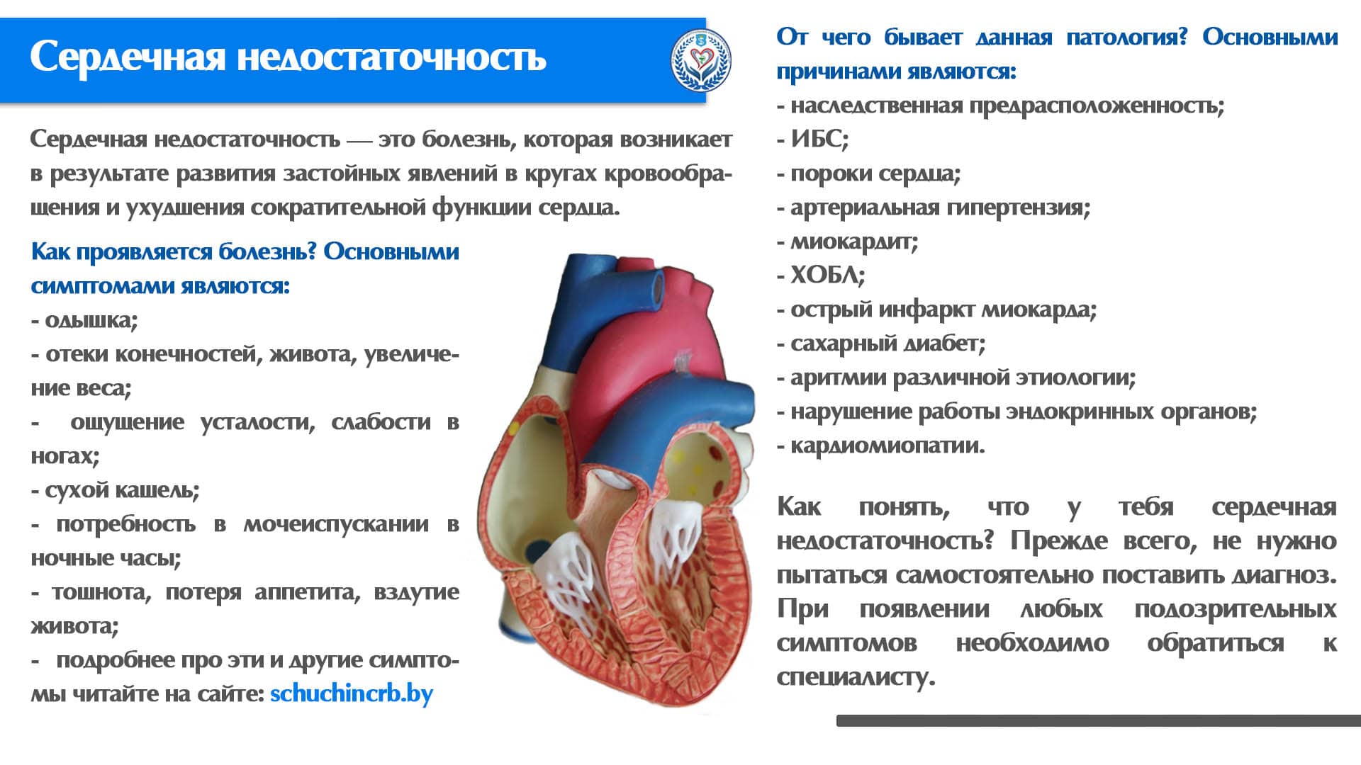 Сердечная недостаточность
