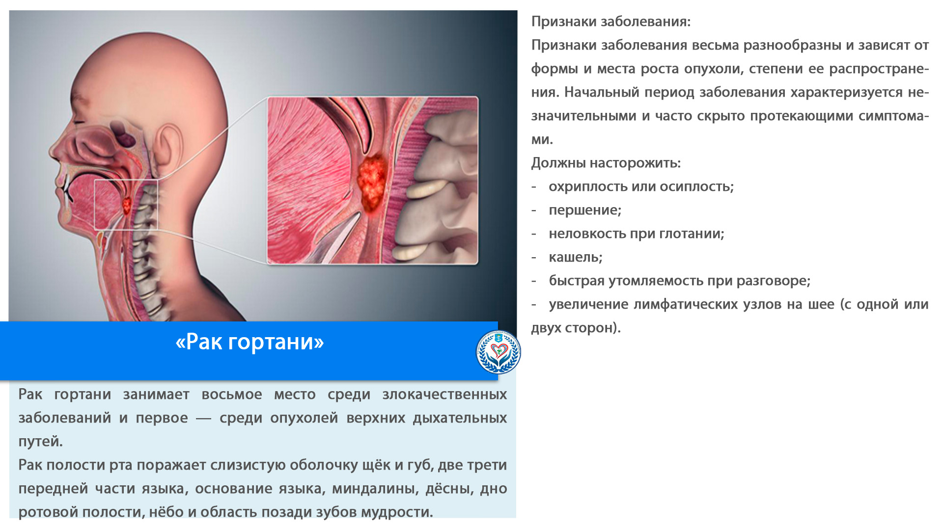 «Рак гортани»