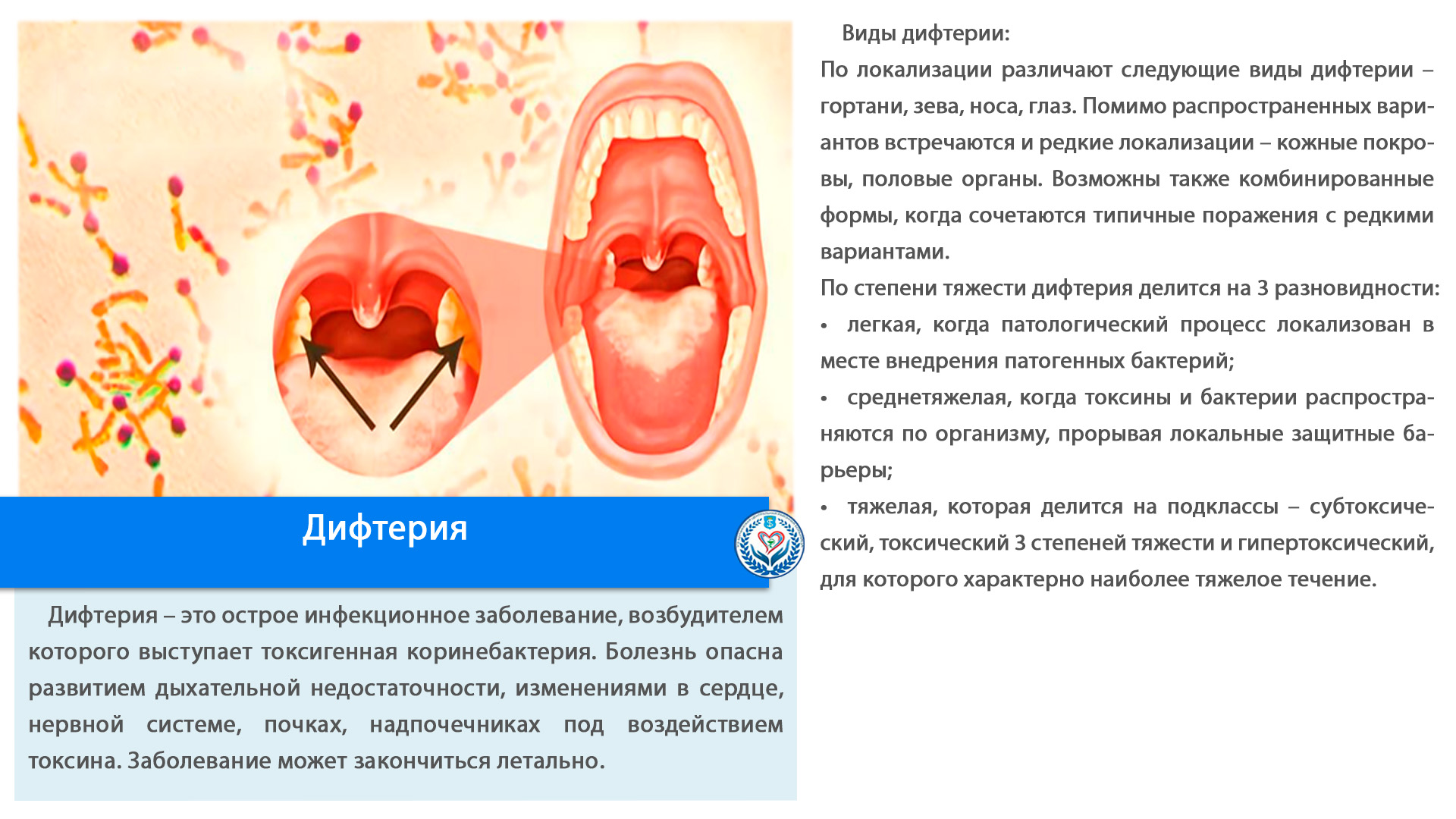 Дифтерия