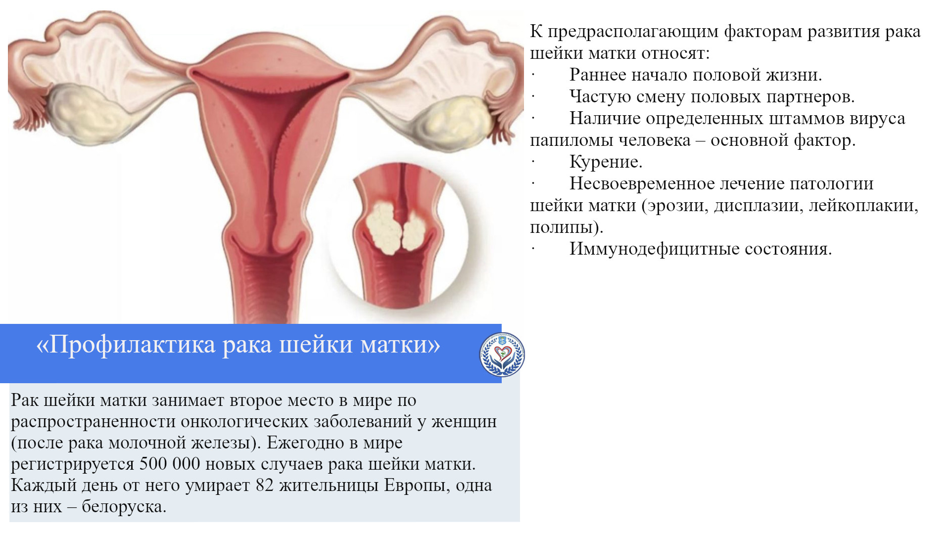 «Профилактика рака шейки матки»