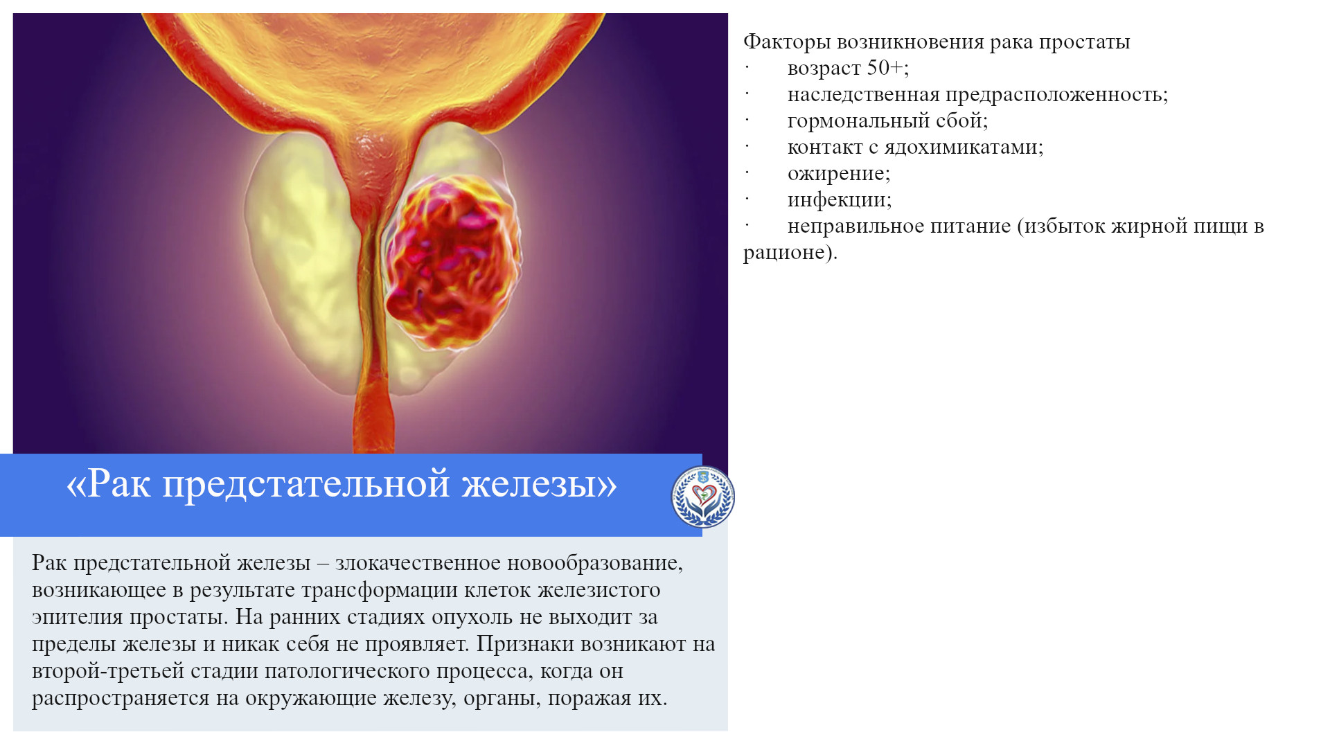 «Рак предстательной железы»