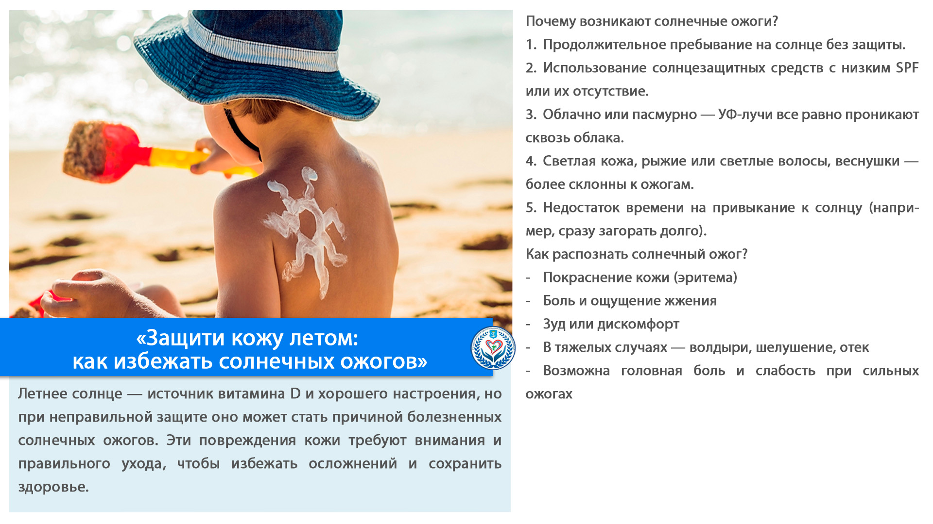 «Защити кожу летом: как избежать солнечных ожогов»