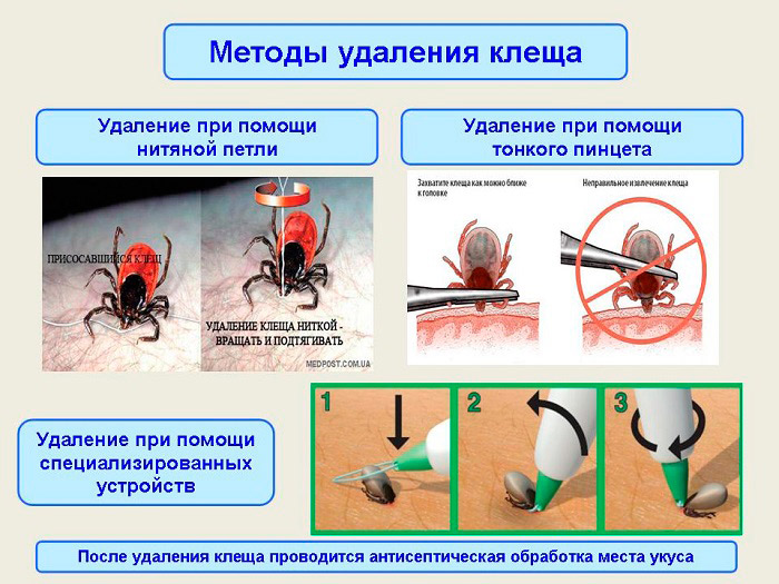 Что делать, если укусил клещ?