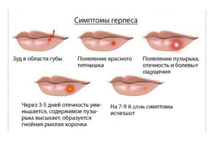 симптомы.jpg